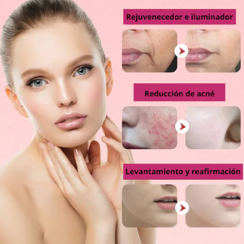 Masajeador Facial  Revital™